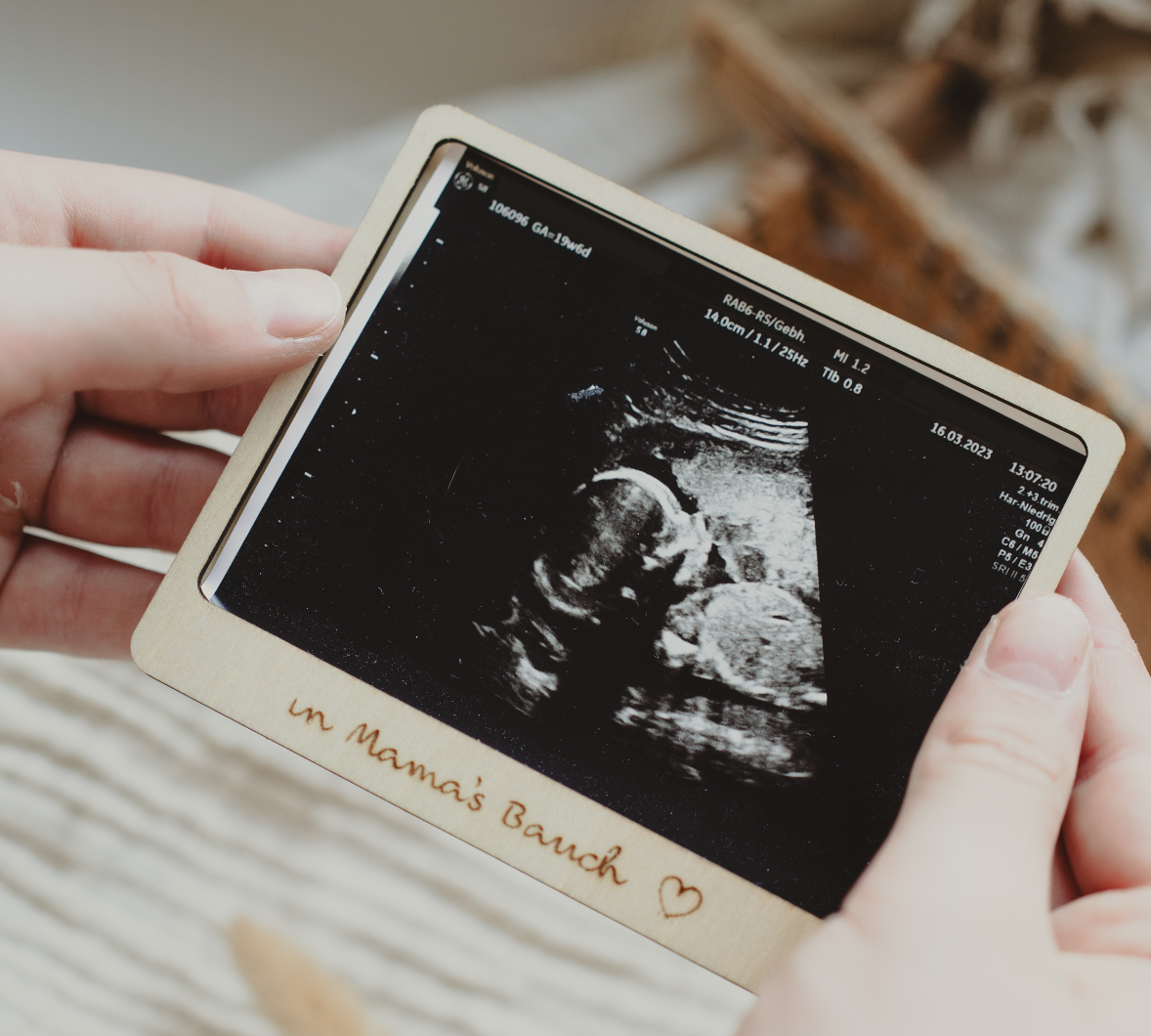 Baby Ultrasound Photo Frame