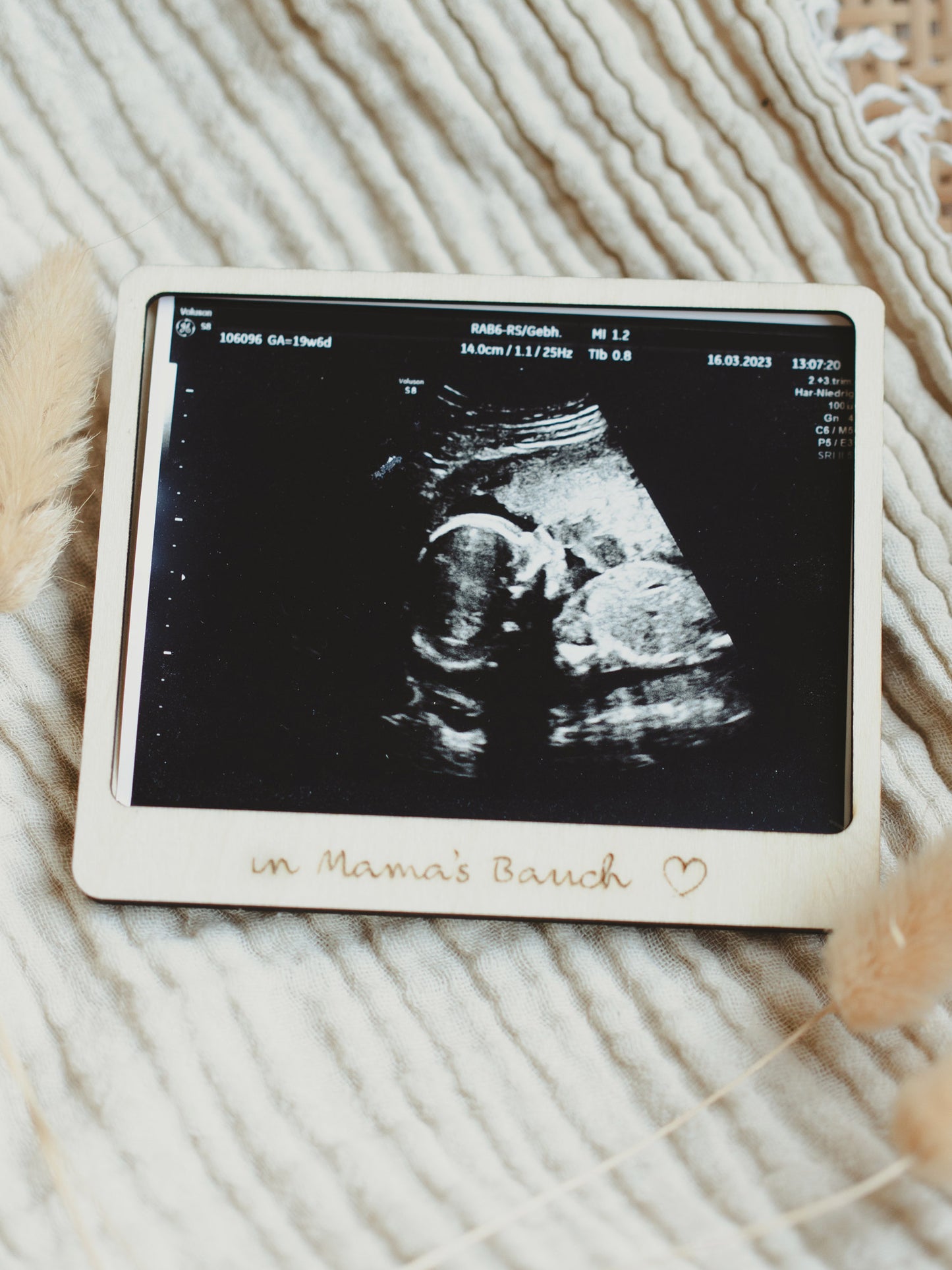 Baby Ultrasound Photo Frame