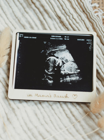 Baby Ultrasound Photo Frame