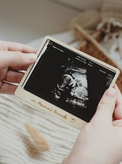 Baby Ultrasound Photo Frame