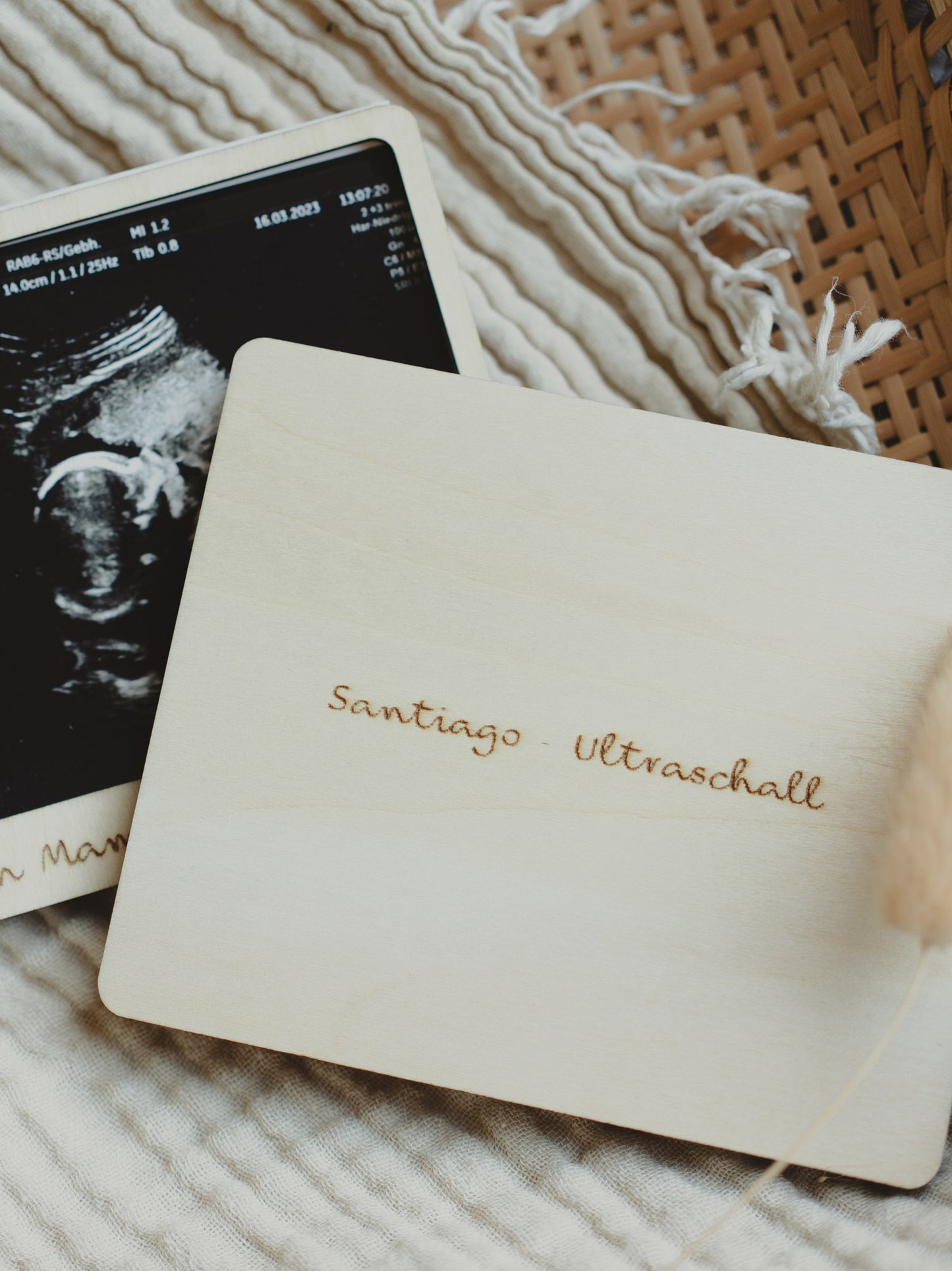 Baby Ultrasound Photo Frame